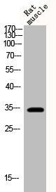 Western Blot analysis of rat-musle cells using Phospho-Cyclin D1 (T286) Polyclonal Antibody