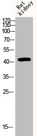 Western Blot analysis of Rat-kidney cells using Phospho-KOR-1 (S369) Polyclonal Antibody