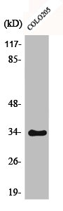 Western Blot analysis of COLO205 cells using Phospho-Cdk2/Cdc2 (T160) Polyclonal Antibody