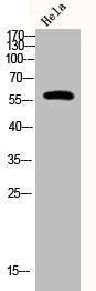 Phospho-PFKFB2 (S483) Antibody – Figure 1 of 2