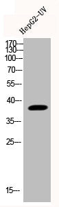 Phospho-MAPK14 (Y323) Antibody – Figure 1 of 3