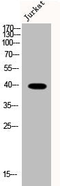 Western Blot analysis of Jurkat cells using Phospho-Smad3 (S208) Polyclonal Antibody