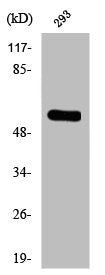 Western Blot analysis of 293 cells using Phospho-TH (S19) Polyclonal Antibody