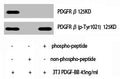 Phospho-PDGFRB (Y1021) Antibody – Figure 1 of 1