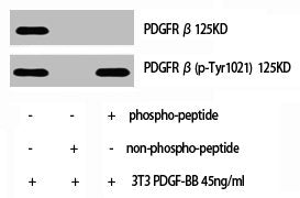 Phospho-PDGFRB (Y1021) Antibody – Figure 1 of 1
