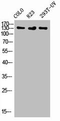 Western Blot analysis of COLO 823 293T-UV cells using Phospho-Flt-1 (Y1048) Polyclonal Antibody