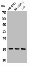 Western Blot analysis of SH-SY5Y 293 SK-HEP-1 cells using Phospho-Synuclein-α (Y125) Polyclonal Antibody