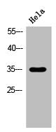 Western Blot analysis of Hela cells using 11β-HSD1 Polyclonal Antibody