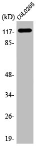 ADCY1 Antibody – Figure 1 of 2