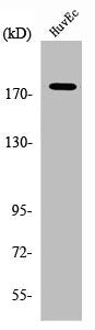 Western Blot analysis of HuvEc cells using ABCA8 Polyclonal Antibody