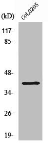 Western Blot analysis of COLO205 cells using ABHD6 Polyclonal Antibody