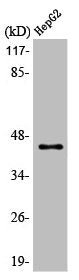 Western Blot analysis of A549 cells using ACAT-1 Polyclonal Antibody