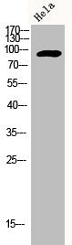 Western Blot analysis of HELA cells using Adducin α/β Polyclonal Antibody