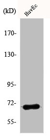 Western Blot analysis of Jurkat cells using AIF-M1 Polyclonal Antibody