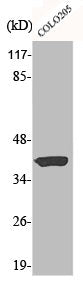 Western Blot analysis of COLO205 cells using Aldolase A Polyclonal Antibody