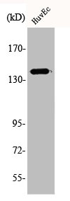 Western Blot analysis of HuvEc cells using Amyloid-β Polyclonal Antibody