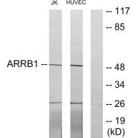 Western blot analysis of extracts from Jurkat cells and HUVEC cells, using ARRB1 antibody.