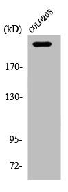 Western Blot analysis of COLO205 cells using APC Polyclonal Antibody