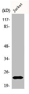 Western Blot analysis of Jurkat cells using Bad Polyclonal Antibody