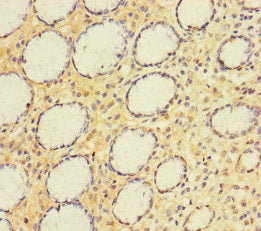 A4GNT Antibody, FITC conjugated – Figure 1 of 2