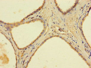 AADAC Antibody, Biotin conjugated – Figure 1 of 2