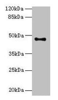 Western blot
All lanes: AADACL2 antibody at 1:500 + PC-3 whole cell lysate
Secondary
Goat polyclonal to rabbit IgG at 1/10000 dilution
Predicted band size: 47, 6 kDa
Observed band size: 47 kDa
