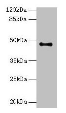 Western blot
All lanes: AADACL2 antibody at 1:500 + PC-3 whole cell lysate
Secondary
Goat polyclonal to rabbit IgG at 1/10000 dilution
Predicted band size: 47, 6 kDa
Observed band size: 47 kDa