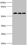 Western blot
All lanes: 4-aminobutyrate aminotransferase, mitochondrial antibody at 10ug/ml
Lane 1: Rat liver tissue
Lane 2: Mouse pancreatic tissue
Lane 3: Mouse kidney tissue
Secondary
Goat polyclonal to rabbit IgG at 1/10000 dilution
Predicted band size: 56 kDa
Observed band size: 56 kDa
