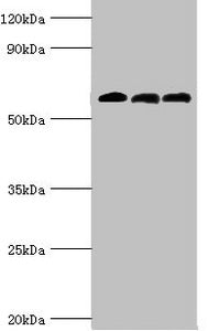 Western blot
All lanes: 4-aminobutyrate aminotransferase, mitochondrial antibody at 10ug/ml
Lane 1: Rat liver tissue
Lane 2: Mouse pancreatic tissue
Lane 3: Mouse kidney tissue
Secondary
Goat polyclonal to rabbit IgG at 1/10000 dilution
Predicted band size: 56 kDa
Observed band size: 56 kDa