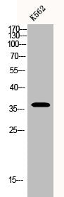 Western Blot analysis of K562 cells using BNIP-2 Polyclonal Antibody