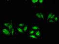 Immunofluorescent analysis of HepG2 cells using CSB-PA001063LA01HU at dilution of 1:100 and Alexa Fluor 488-congugated AffiniPure Goat Anti-Rabbit IgG(H+L)