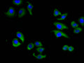 Immunofluorescence staining of A549 cells with CSB-PA001065LA01HU at 1:133, counter-stained with DAPI. The cells were fixed in 4% formaldehyde, permeabilized using 0.2% Triton X-100 and blocked in 10% normal Goat Serum. The cells were then incubated with the antibody overnight at 4&deg;C. The secondary antibody was Alexa Fluor 488-congugated AffiniPure Goat Anti-Rabbit IgG(H+L).