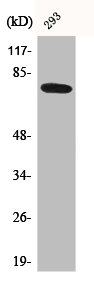 Western Blot analysis of 293 cells using Btk Polyclonal Antibody