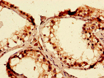 Immunohistochemistry of paraffin-embedded human testis tissue using CSB-PA001080LA01HU at dilution of 1:100