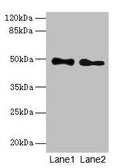 Western blot
All lanes: ABHD2 antibody at 10µg/ml
Lane 1: Mouse heart tissue
Lane 2: Rat gonadal tissue
Secondary
Goat polyclonal to rabbit IgG at 1/10000 dilution
Predicted band size: 49 kDa
Observed band size: 49 kDa