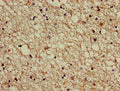 Immunohistochemistry of paraffin-embedded human brain tissue using CSB-PA001102LA01HU at dilution of 1:100