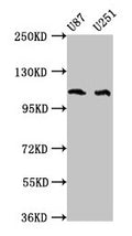 Western Blot
Positive WB detected in: U87 whole cell lysate, U251 whole cell lysate
All lanes: ABL2 antibody at 4µg/ml
Secondary
Goat polyclonal to rabbit IgG at 1/50000 dilution
Predicted band size: 129, 125, 127, 115, 118, 116, 117, 61 kDa
Observed band size: 115 kDa