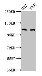 Western Blot
Positive WB detected in: U87 whole cell lysate, U251 whole cell lysate
All lanes: ABL2 antibody at 4µg/ml
Secondary
Goat polyclonal to rabbit IgG at 1/50000 dilution
Predicted band size: 129, 125, 127, 115, 118, 116, 117, 61 kDa
Observed band size: 115 kDa