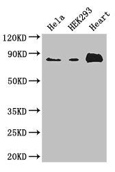 Western Blot
Positive WB detected in: Hela whole cell lysate, HEK293 whole cell lysate, Mouse heart tissue
All lanes: ABLIM1 antibody at 3.4ug/ml
Secondary
Goat polyclonal to rabbit IgG at 1/50000 dilution
Predicted band size: 88, 82, 49, 47, 53, 85 kDa
Observed band size: 88 kDa