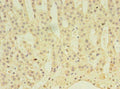 ABLIM3 Antibody, Biotin conjugated – Figure 1 of 3