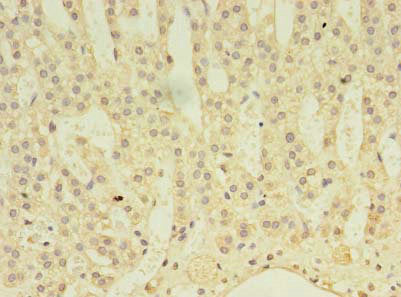 ABLIM3 Antibody, FITC conjugated – Figure 1 of 3