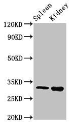 Western Blot
Positive WB detected in: Mouse spleen tissue, Mouse kidney tissue
All lanes: ABT1 antibody at 3ug/ml
Secondary
Goat polyclonal to rabbit IgG at 1/50000 dilution
Predicted band size: 32 kDa
Observed band size: 32 kDa