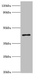 Western blot
All lanes: 3-ketoacyl-CoA thiolase, peroxisomal antibody at 8ug/ml + Mouse liver tissue
Secondary
Goat polyclonal to rabbit IgG at 1/10000 dilution
Predicted band size: 45, 35 kDa
Observed band size: 45 kDa
