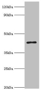 Western blot
All lanes: 3-ketoacyl-CoA thiolase, peroxisomal antibody at 8ug/ml + Mouse liver tissue
Secondary
Goat polyclonal to rabbit IgG at 1/10000 dilution
Predicted band size: 45, 35 kDa
Observed band size: 45 kDa