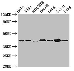Western Blot
Positive WB detected in: Hela whole cell lysate, A549 whole cell lysate, NIH/3T3 whole cell lysate, HepG2 whole cell lysate, Rat lung tissue, Mouse liver tissue, Mouse lung tissue
All lanes: ACAA2 antibody at 2.4µg/ml
Secondary
Goat polyclonal to rabbit IgG at 1/50000 dilution
Predicted band size: 42 kDa
Observed band size: 42 kDa
