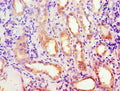 Immunohistochemistry of paraffin-embedded human kidney tissue using CSB-PA001126ESR2HU at dilution of 1:100