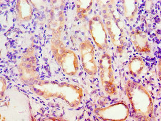 Immunohistochemistry of paraffin-embedded human kidney tissue using CSB-PA001126ESR2HU at dilution of 1:100