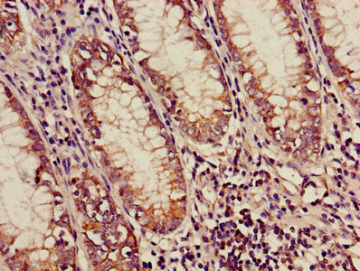 ACADM Antibody, Biotin conjugated – Figure 1 of 2