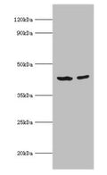 Western blot
All lanes: Short-chain specific acyl-CoA dehydrogenase, mitochondrial antibody at 7ug/ml
Lane 1: 293T whole cell lysate
Lane 2: HepG2 whole cell lysate
Secondary
Goat polyclonal to rabbit IgG at 1/10000 dilution
Predicted band size: 44 kDa
Observed band size: 44 kDa