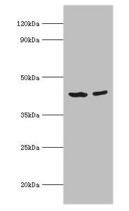 Western blot
All lanes: Short-chain specific acyl-CoA dehydrogenase, mitochondrial antibody at 7ug/ml
Lane 1: 293T whole cell lysate
Lane 2: HepG2 whole cell lysate
Secondary
Goat polyclonal to rabbit IgG at 1/10000 dilution
Predicted band size: 44 kDa
Observed band size: 44 kDa